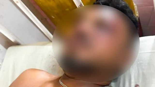 “যখন উঠে দাঁড়ালাম, চারপাশে শুধু লাশ” — বিমানের একমাত্র বেঁচে যাওয়া যাত্রী বিশ্ব কুমার রমেশ