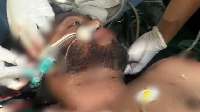 ওসমান হাদির সর্বশেষ শারীরিক অবস্থা জানালেন চিকিৎসক