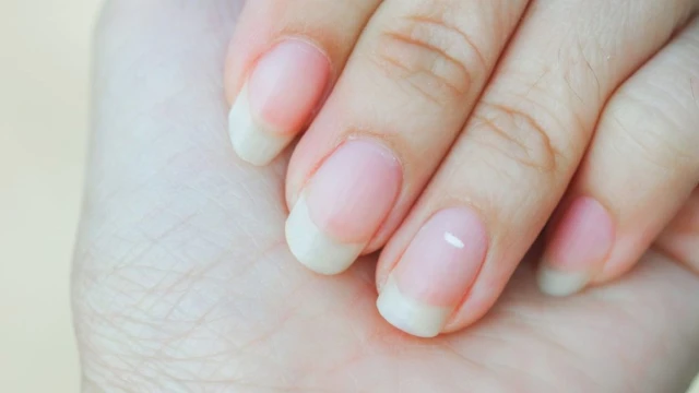 নখের এই ৫টি পরিবর্তন অবহেলা নয়, হতে পারে বড় রোগের সতর্কবার্তা