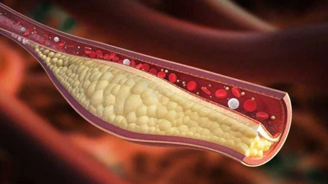 পরিবারে কোলেস্টেরলের ঝুঁকি থাকলে খাদ্যাভ্যাসে যেসব পরিবর্তন জরুরি