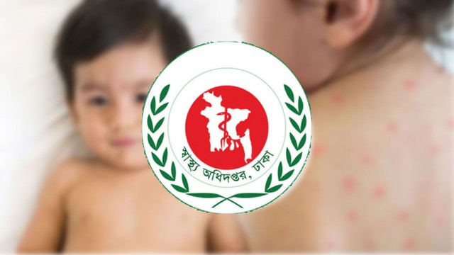 হামের উপসর্গে একদিনে আরও ১২ শিশুর মৃত্যু, আক্রান্ত বেড়েই চলেছে