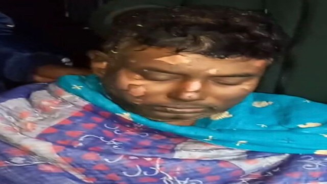 ডামুড্যায় ব্যবসায়ীকে ছুরিকাঘাতের পর শরীরে আগুন