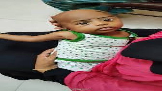 জন্মের পরপরই শিশুর থাইরয়েড পরীক্ষা অত্যন্ত জরুরি