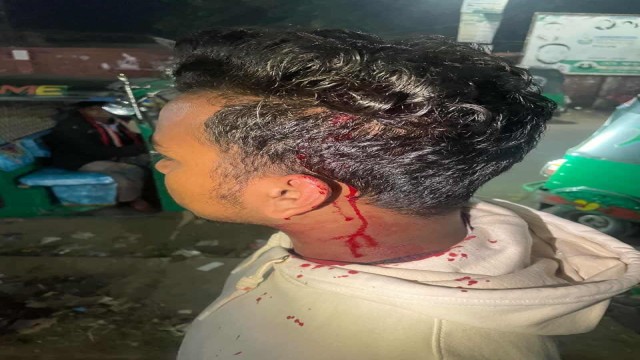 বাহুবলে বিএনপি কর্মীকে কুপিয়ে আহত
