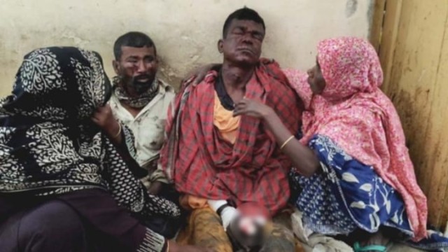 শার্শার বালুন্ডায় মাটি কাটার সময় ককটেল বিস্ফোরণ, আহত ২