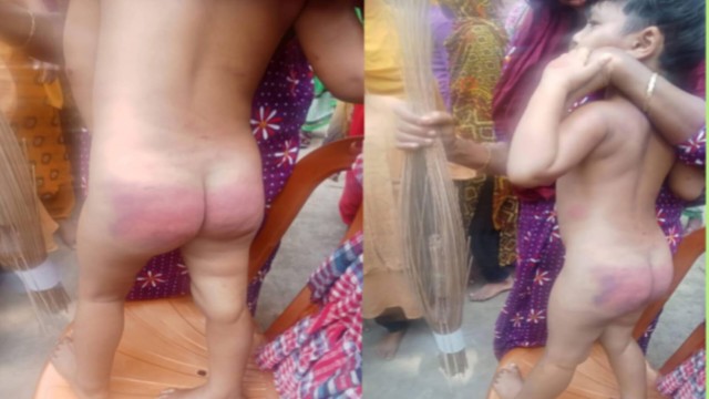 নির্যাতনে জর্জরিত শিশু সোহা মনি, পলাতক সৎ মা