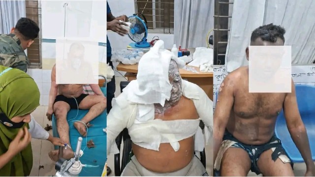 কুমিল্লার চৌদ্দগ্রাম উপজেলায় একটি গার্মেন্টস কারখানায় বৈদ্যুতিক শর্ট সার্কিটের ঘটনায় তিন শ্রমিক আহত...