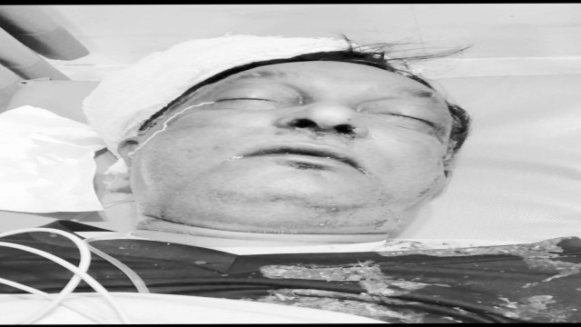 ফেনীতে সড়ক দুর্ঘটনায় চৌদ্দগ্রামের বিএনপি নেতার মৃত্যু